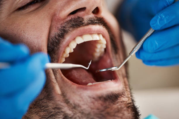 Best Knocked-Out Tooth Emergency  in Jacksonville, FL